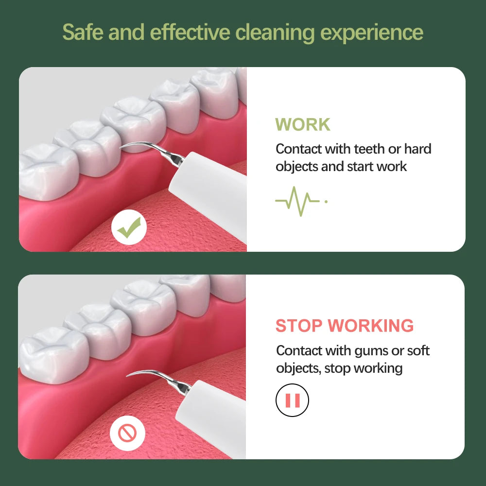 Dental Scaler with HD Endoscope Visual Display