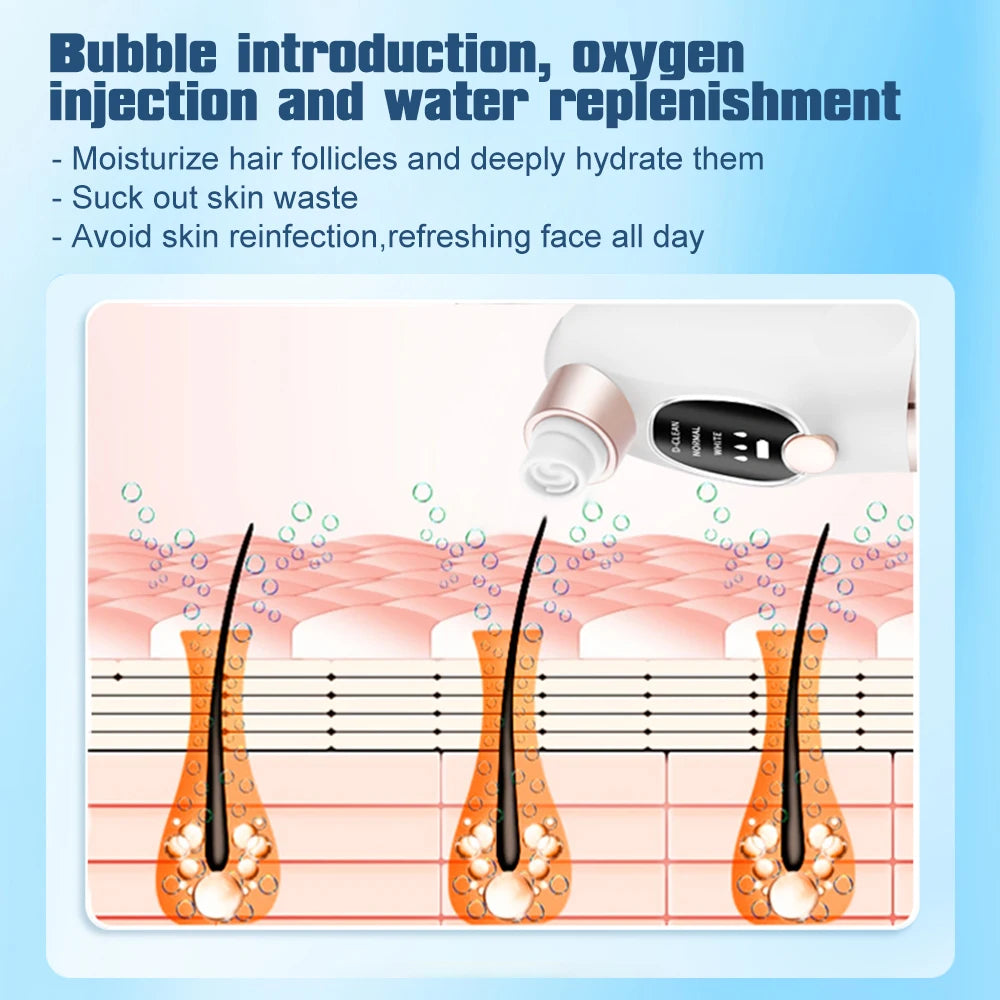 Adjustable Suction Blackhead Remover