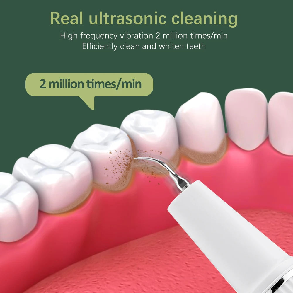 Dental Scaler with HD Endoscope Visual Display