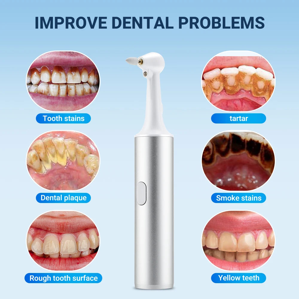 5-in-1 Electric Tooth Polisher: USB Rechargeable