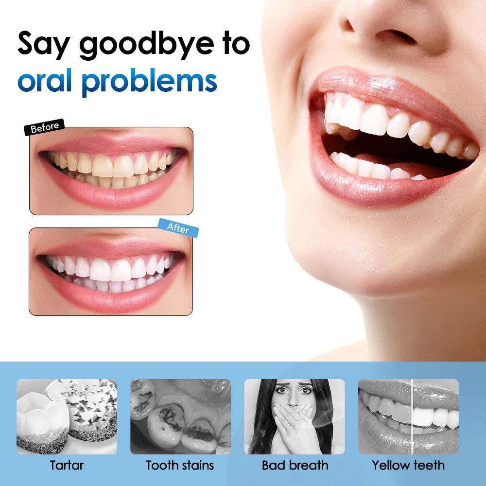 Teeth Whitening Sonic Scaler: Removes Plaque, Calculus, and Stains