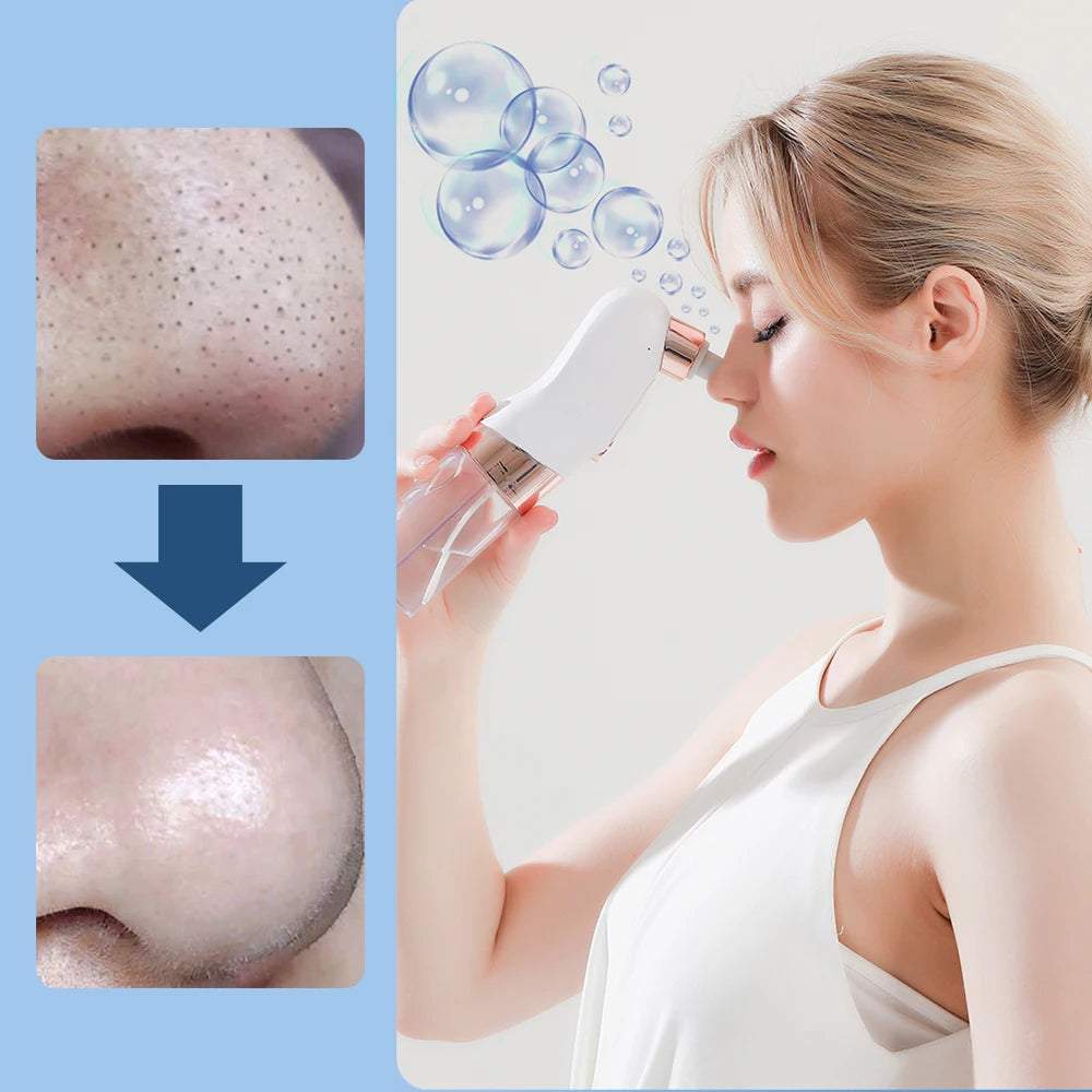 Adjustable Suction Blackhead Remover