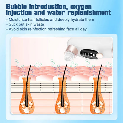 Adjustable Suction Blackhead Remover