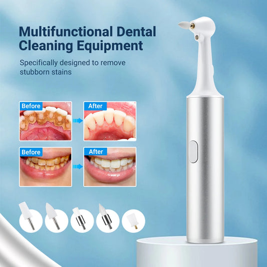 5-in-1 Electric Tooth Polisher: USB Rechargeable